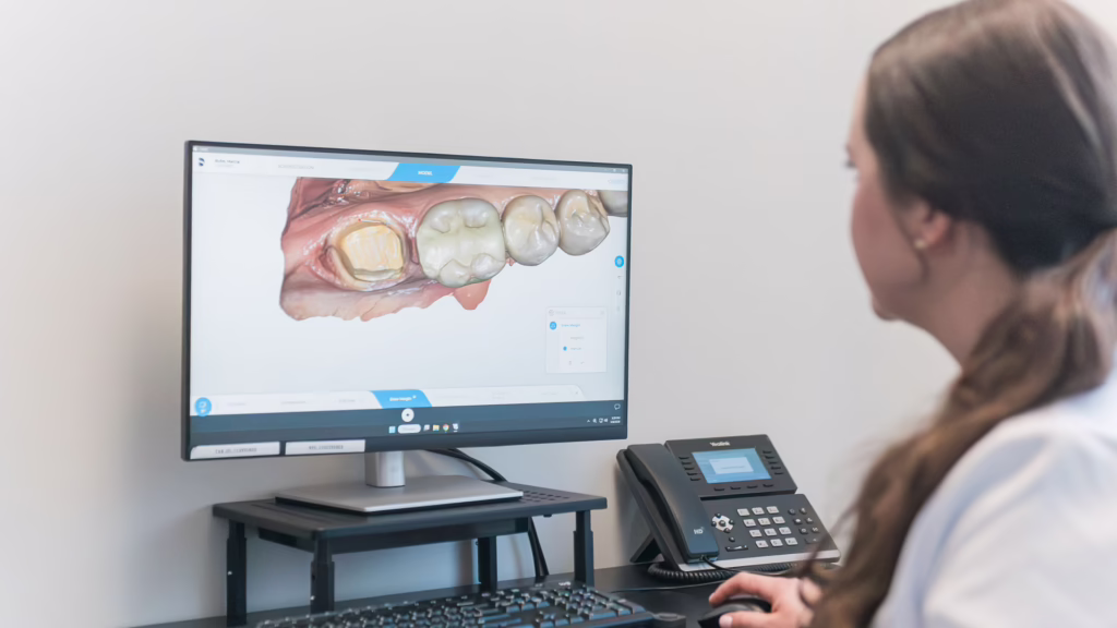 Dental professional viewing a 3D tooth model on a computer monitor for dental planning/analysis